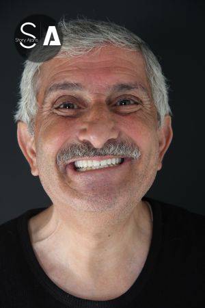 Ahmet Y.